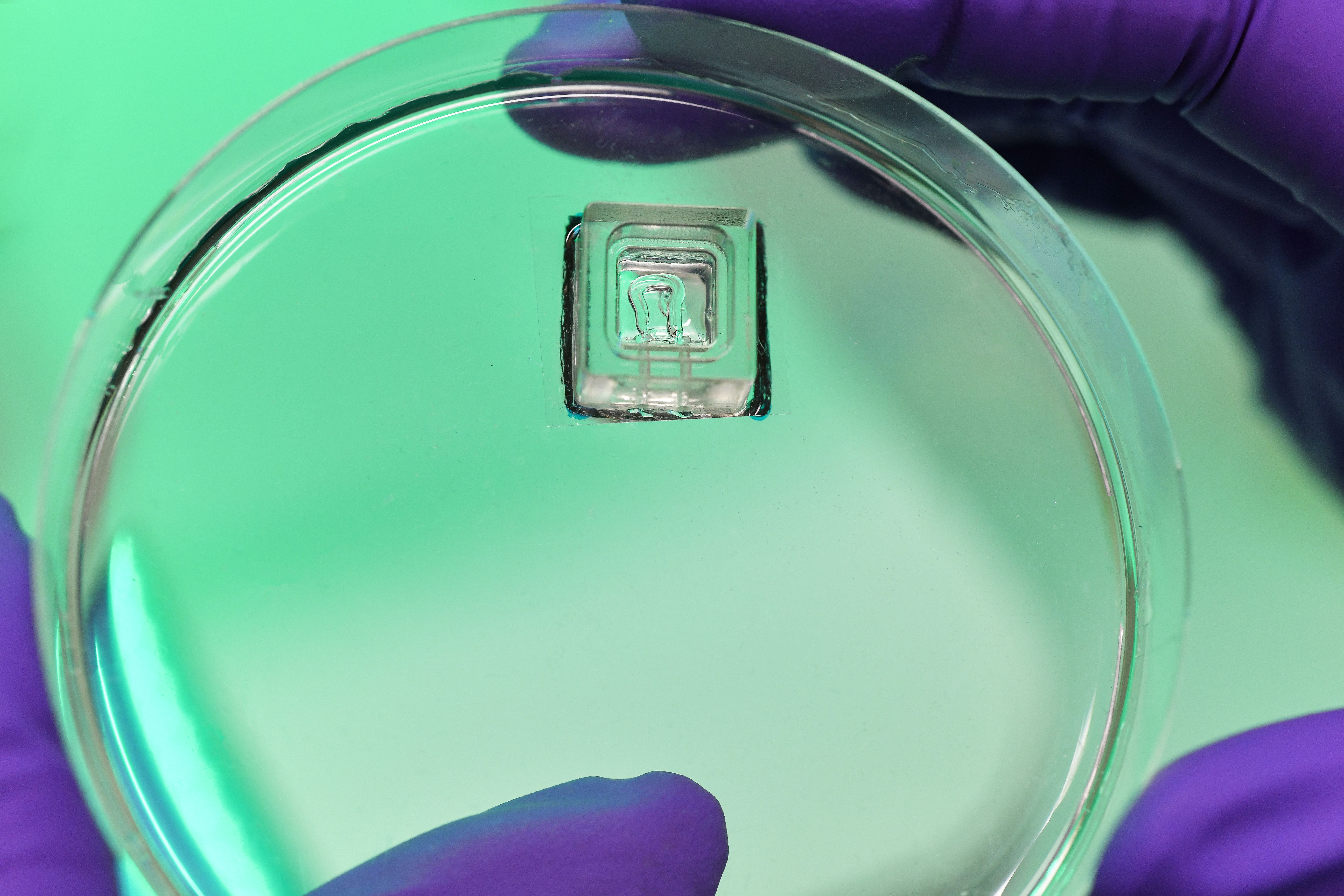 Tumor-on-a-chip to improve patient care (TME On Chip) 