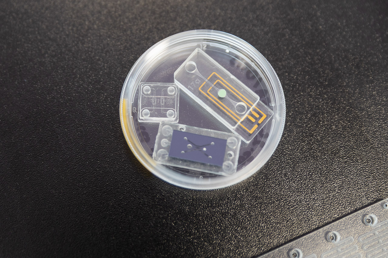  Tumeur sur puce pour amélioration du soin du patient (TME On Chip) 