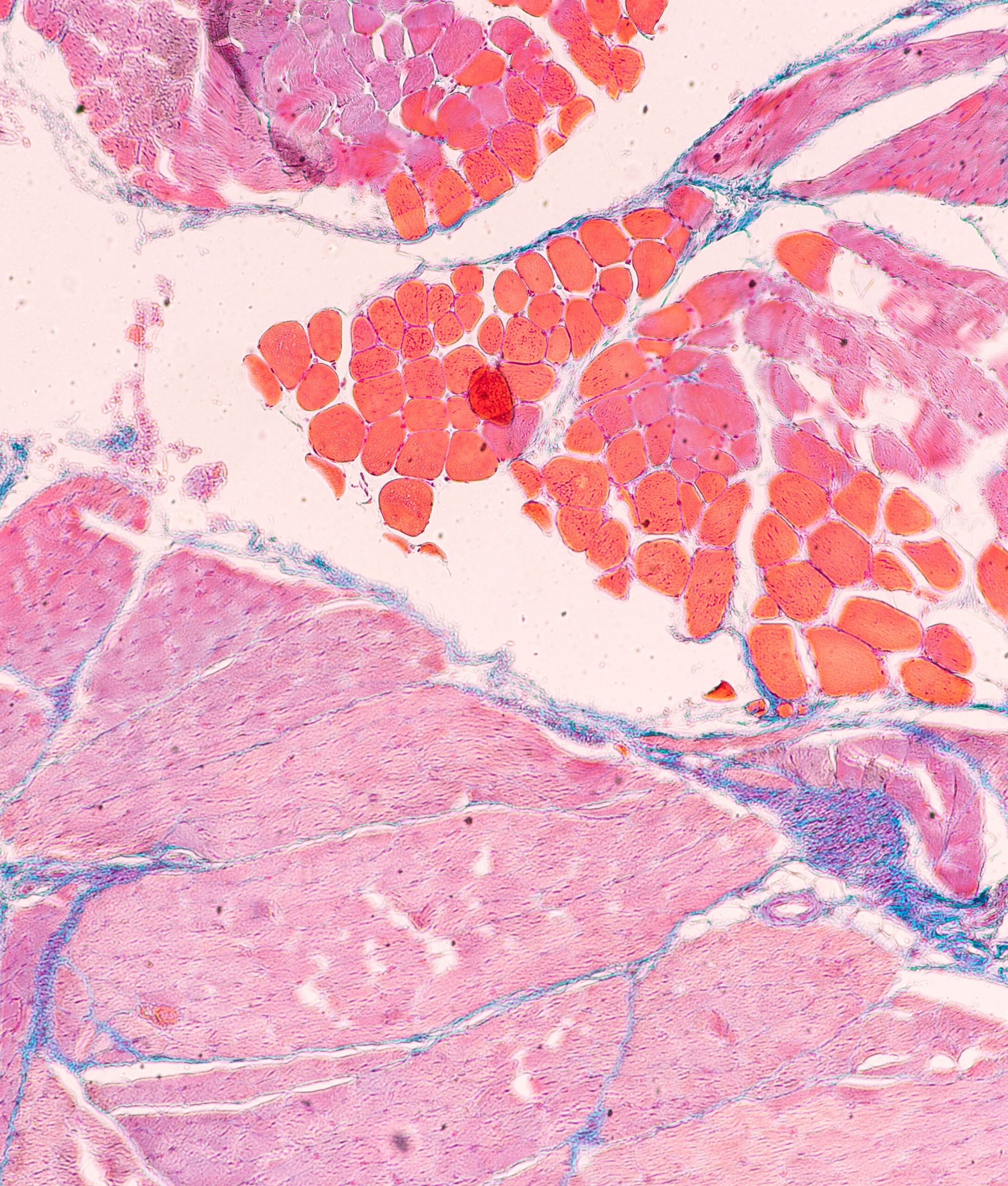  La complexité du muscle squelettique récapitulée sur une puce pour modéliser les maladies neuromusculaires et prédire l&rsquo;efficacité des traitements (MUSCLOR-oC) 